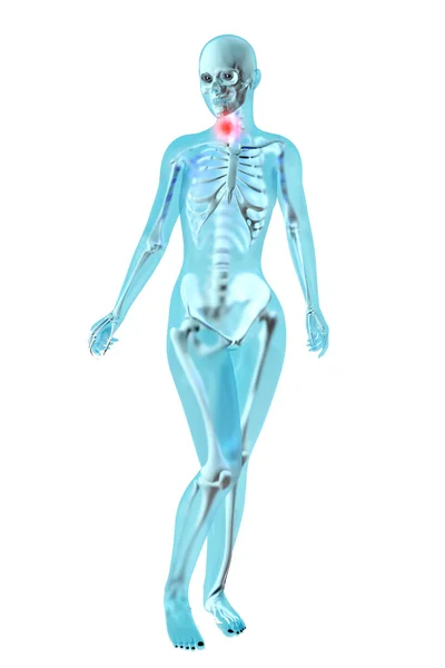 Anatomia Feminina - Dor de garganta — Fotografia de Stock
